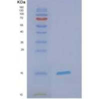 人EIF1B重组蛋白