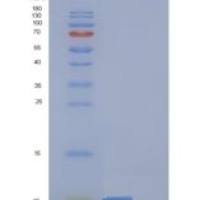 人表皮调节素(EREG)重组蛋白