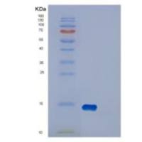 人DYNLT1重组蛋白