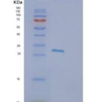 人ETHE1重组蛋白