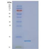 人DPY30重组蛋白