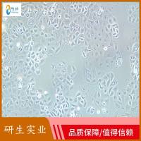 大鼠视网膜Muller细胞