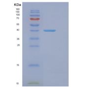 人真核翻译起始因子3F(EIF3F)重组蛋白