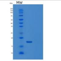 人DUSP23重组蛋白