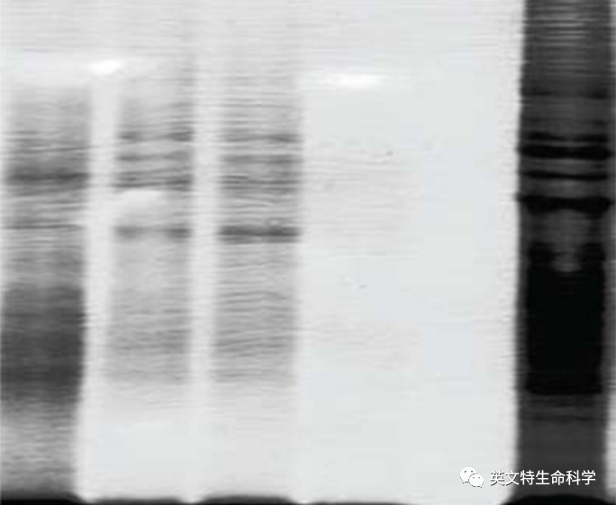 脂肪组织提蛋白，其实没有那么难！