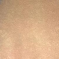 人中耳上皮细胞HMEEpic