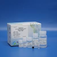 粪便总DNA提取试剂（磁珠法）