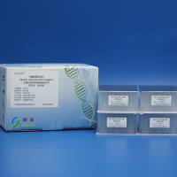 血清/血浆病毒核酸提取试剂(磁珠法)