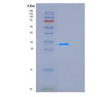 人谷氨酸半胱氨酸连接酶(GCLM)重组蛋白