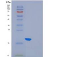 人Fms相关酪氨酸激酶3配体重组蛋白