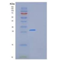 人叶酸受体1(FOLR1)重组蛋白