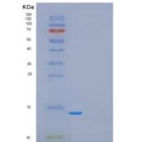 人果蝇GAGA-POZ结构域重组蛋白