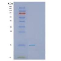 人GAGE2D重组蛋白