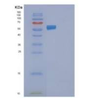 人FAAH2重组蛋白