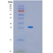 人Aequorea 维多利亚GFP(Aequorea victoriaGFP)重组蛋白产品图