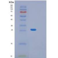 人Aequorea 维多利亚GFP(Aequorea victoriaGFP)重组蛋白