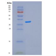人FOSL2重组蛋白