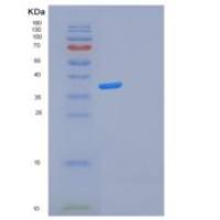 人FOSL2重组蛋白