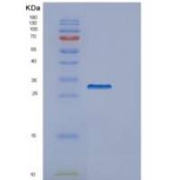 人甘氨酰tRNA合成酶(GARS)重组蛋白