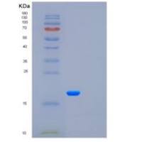 人粒细胞集落刺激因子(GCSF)重组蛋白