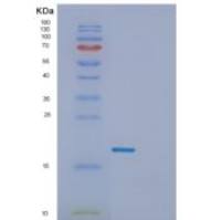 人生长停滞DNA损伤可诱导蛋白γ(GADD45g)重组蛋白