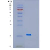 人GABARAPL1重组蛋白