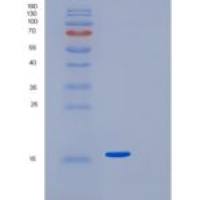 人生长分化因子5(GDF5)重组蛋白