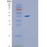 人FK506结合蛋白样蛋白(FKBPL)重组蛋白