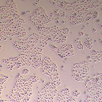 CMT93小鼠结肠癌细胞丨CMT93细胞株丨逸漠(immocell)