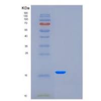 人FXYD5重组蛋白