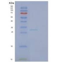 人纤维蛋白(FBL)重组蛋白