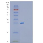 人FK506结合蛋白3(FKBP3)重组蛋白产品图