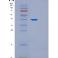 人FKBP6重组蛋白