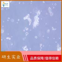 猪卵巢内膜细胞