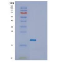 人生长停滞DNA损伤可诱导蛋白α(GADD45a)重组蛋白