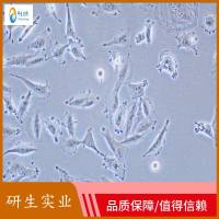 小鼠纹状体神经元细胞