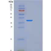 人FN3KRP重组蛋白