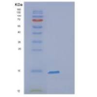 人脑型脂肪酸结合蛋白(FABP7)重组蛋白