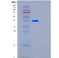 人岩藻糖基转移酶3(FUT3)重组蛋白