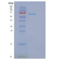 人苯丙氨酰tRNA合成酶β(FARSb)重组蛋白