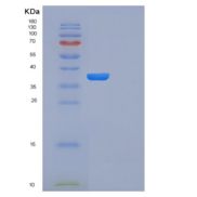 人果糖胺-3-激酶(FN3K)重组蛋白产品图