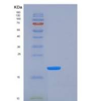 人轻肽铁蛋白(FTL)重组蛋白