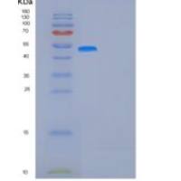 人岩藻糖苷酶αL1(FUCa1)重组蛋白