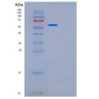 人葡萄糖6磷酸脱氢酶(G6PD)重组蛋白