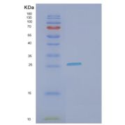 人IgG-Fc片段低亲和力受体Ⅲa(FcgR3A)重组蛋白