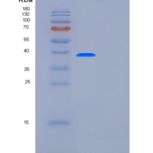 人FUT7重组蛋白产品图