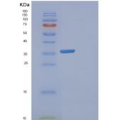 人FAM84B重组蛋白产品图