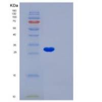 人半乳糖凝集素3(GAL3)重组蛋白