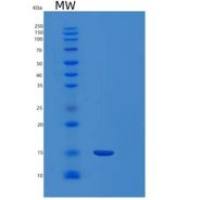 人Ferredoxin 1重组蛋白