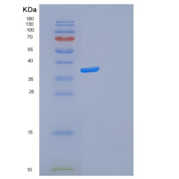 人FOSL2重组蛋白